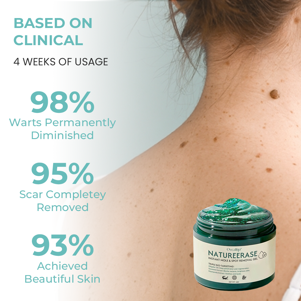 ✅ Official Store: Oveallgo® NatureErase Instant Alligator Oil Mole & Spot Removal Gel