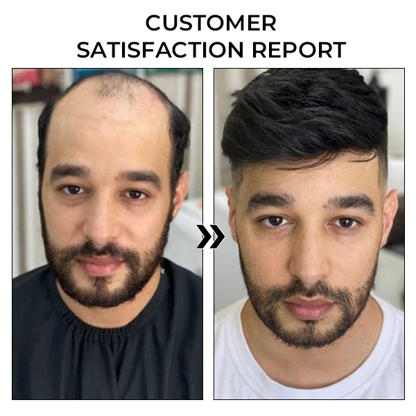 ✅Official Store: Oveallgo™ New BeeGrow Follicle Reviving Hair Essence 🌿 Endorsed by AAAF & TGA(Clinically proven to activate hair follicles, enhance scalp health, reduce inflammation, and prevent hair loss)