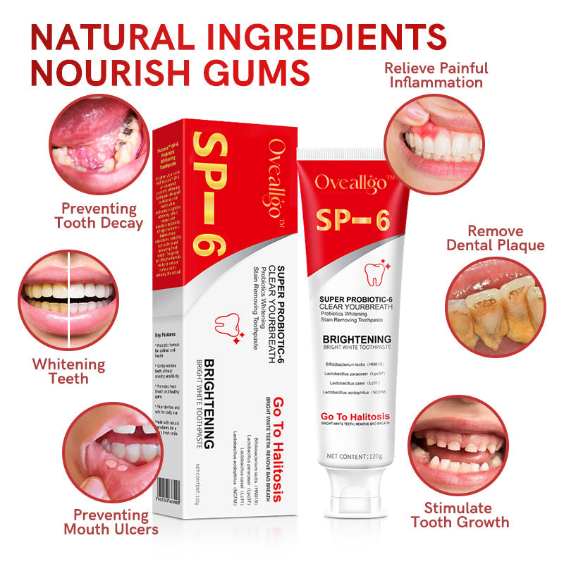 šŖ„Oveallgo⢠Aussie SP-6 Probiotic Ultra Whitening Toothpasteš¦·šØāāļøRecommendationš„75% OFF