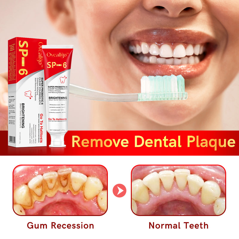 šŖ„Oveallgo⢠Aussie SP-6 Probiotic Ultra Whitening Toothpasteš¦·šØāāļøRecommendationš„75% OFF