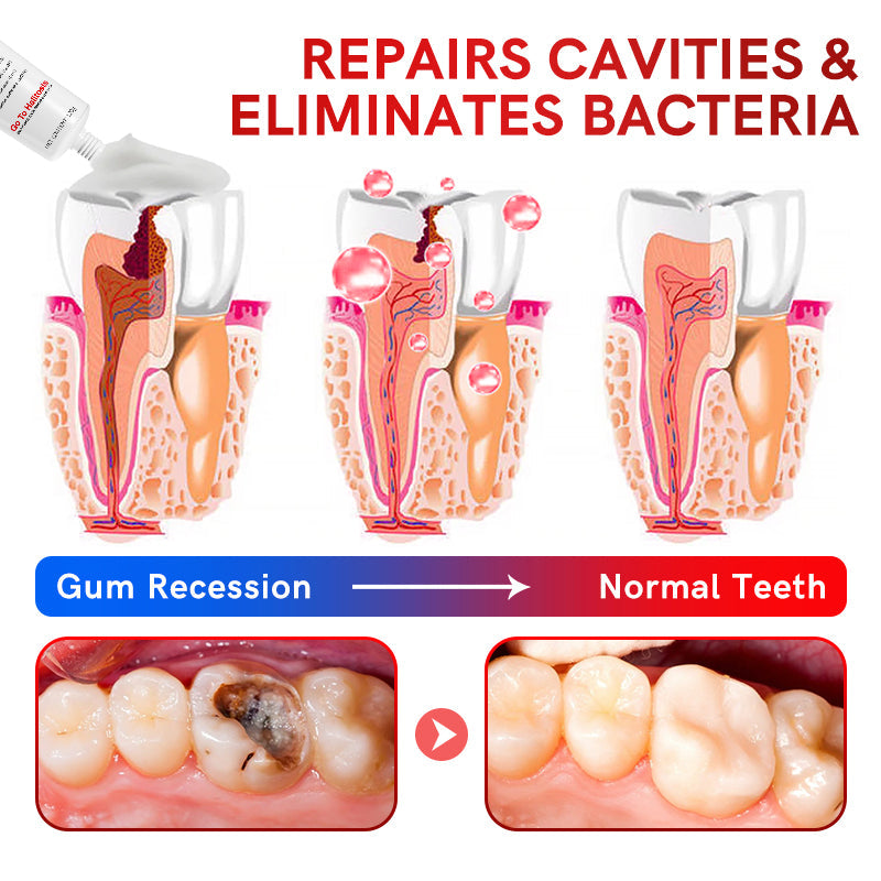 šŖ„Oveallgo⢠Aussie SP-6 Probiotic Ultra Whitening Toothpasteš¦·šØāāļøRecommendationš„75% OFF