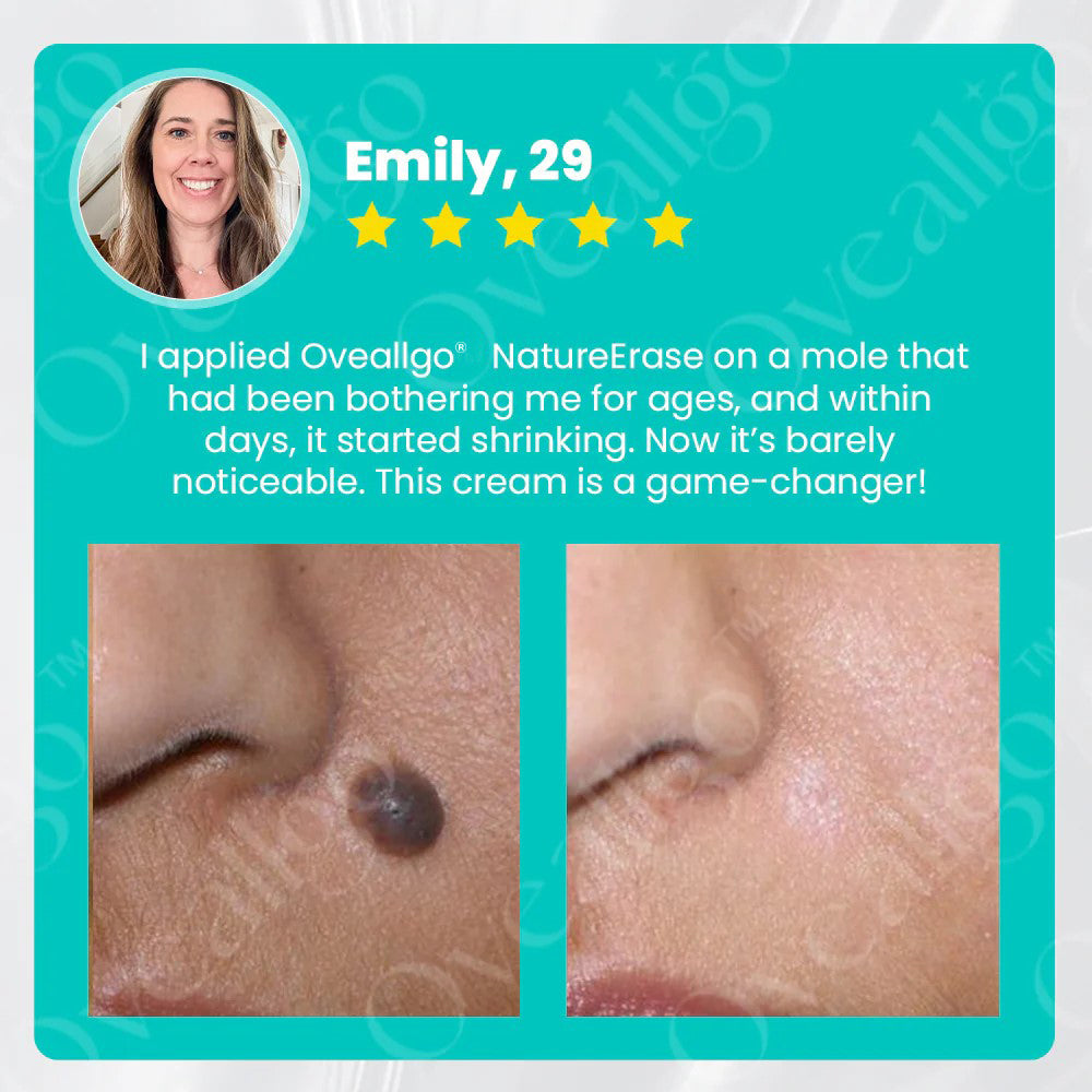✅ Official Store: Oveallgo® NatureErase Instant Alligator Oil Mole & Spot Removal Gel