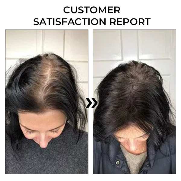 ✅Official Store: Oveallgo™ New BeeGrow Follicle Reviving Hair Essence 🌿 Endorsed by AAAF & TGA(Clinically proven to activate hair follicles, enhance scalp health, reduce inflammation, and prevent hair loss)