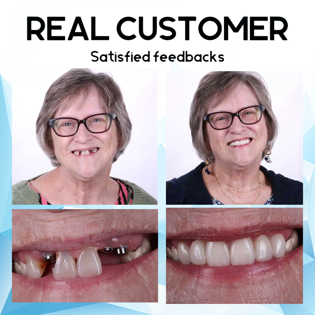 Oveallgo™ Silicone Reline Denture Set🦷