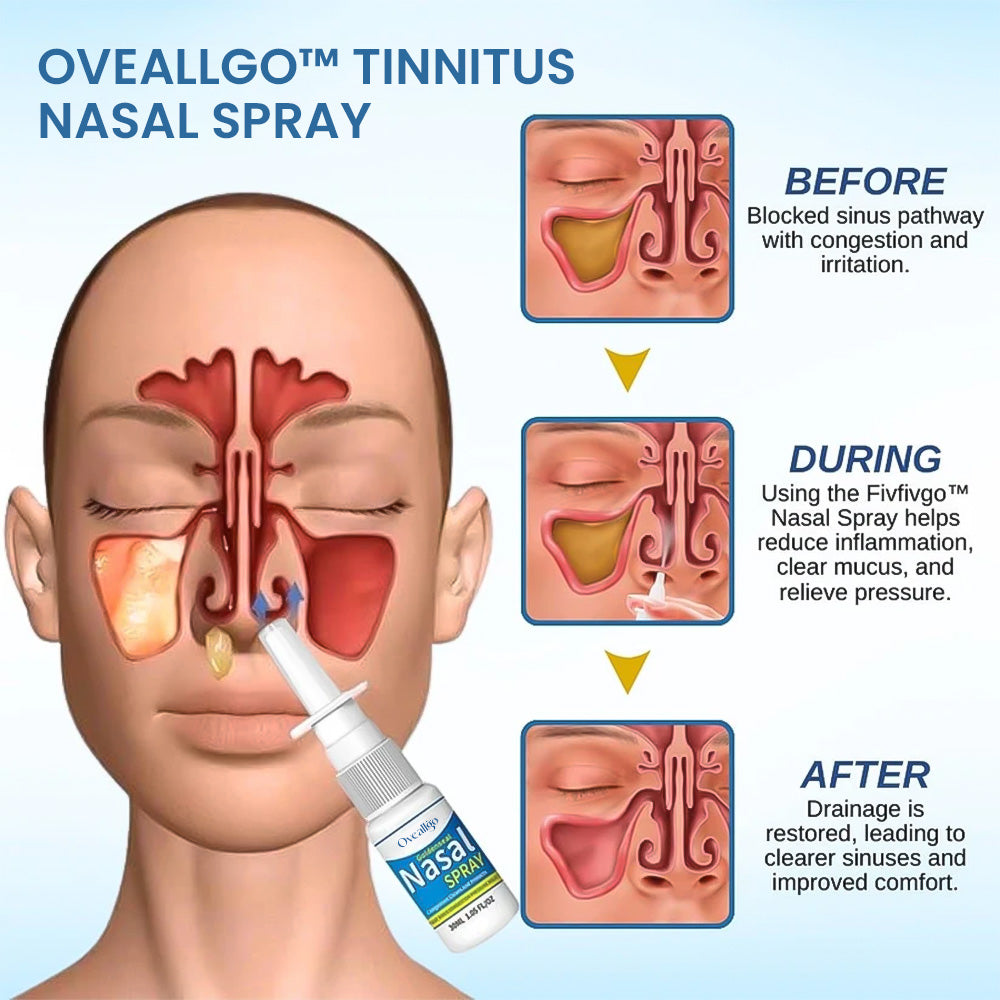 Oveallgo™ Tinnitus Nasal Spray