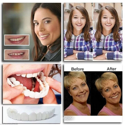 Oveallgo™ Adjustable Snap-On Dentures