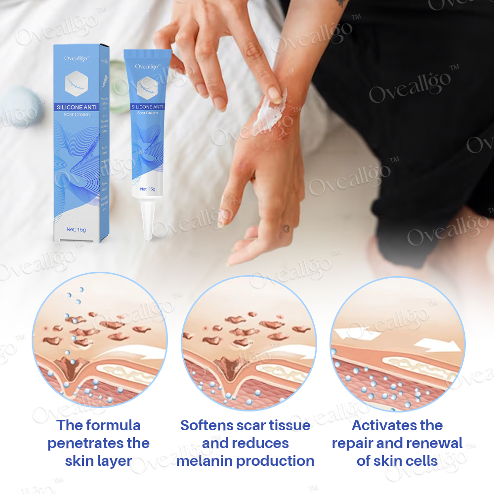 Oveallgo™ Silicone Anti-Scar Cream