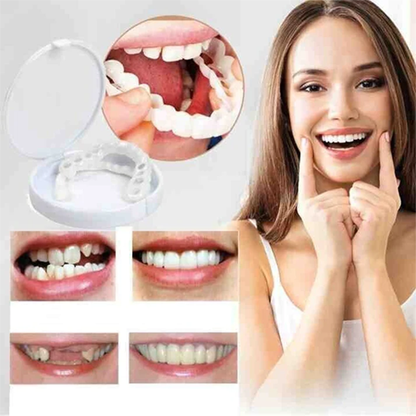 Oveallgo™ Adjustable Snap-On Dentures