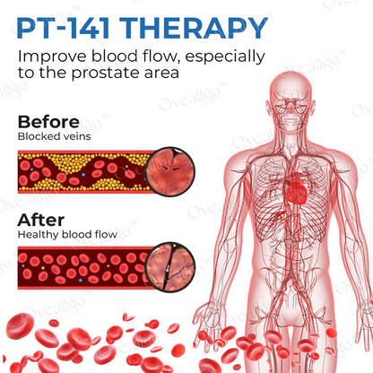 Oveallgo™ EX ProstaAce PT-141 Nasal Spray