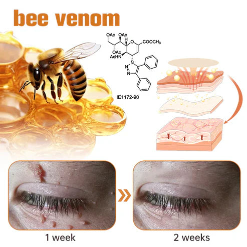 Oveallgo™ WartGone Bee Venom Treatment Patch