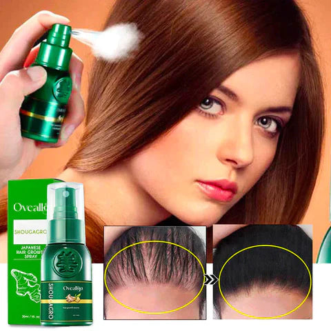 Oveallgo™ ShougaGRO PRO Japanese Hair Growth Spray Plus