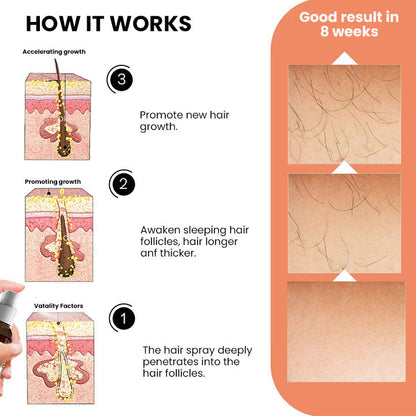 Oveallgo™ EX Ashwagandha 4500 Hair Growth Spray Plus